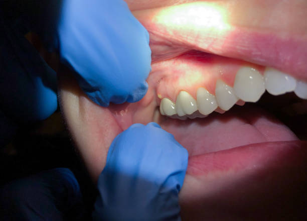 Best Weekend Emergency Dentist in Knightdale, NC