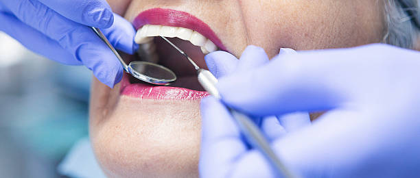 Best Emergency Root Canal Treatment in Knightdale, NC